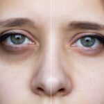 Dark Circles Remove Tips: వావ్ ఇట్స్ అమేజింగ్.. కళ్ల కింద నల్లటి వలయాలను సహజంగా పోగొట్టేయండిలా!