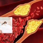 High Cholesterol: పురుషులలో అంగస్తంభన సమస్య.. అసలు కారణం ఇదే!