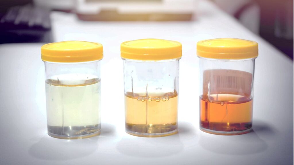 Urine colours