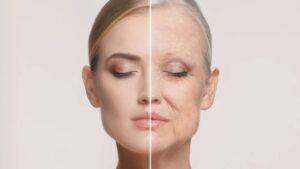 skin health