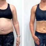 Weight Loss Tips: ఎక్సర్‌సైజ్ చేయకుండా బరువు తగ్గొచ్చు.. డైలీ ఇవి పాటిస్తే చాలు!