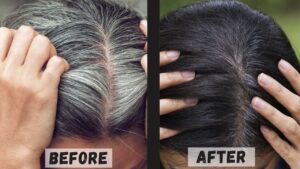 White Hair