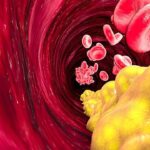 Health Tips: మెడిసిన్ వాడకుండా కొలెస్ట్రాల్‌ కంట్రోల్ చేసేయండిలా!