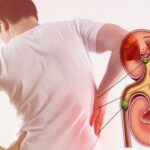 Kidney Stone Problems: కిడ్నీలో రాళ్లు పదేపదే ఏర్పడుతున్నాయా?.. వెంటనే వీటికి దూరంగా ఉండాల్సిందే?