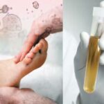High Uric Acid Problems: అధిక యూరిక్ యాసిడ్ వల్ల ఇన్ని సమస్యలా?.. ఇలా వెంటనే తగ్గించుకోండి!