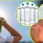 summer health tips: వేసవిలో ఇన్ఫెక్షన్, డీహైడ్రేషన్ సమస్యలకు ఇలా చెక్ పెట్టేయండి.. లేదంటే ఖతం!