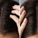 summer hairfall control tips: సమ్మర్‌లో జుట్టు రాలడాన్ని ఇలా తగ్గించేయండి.. వేరీ సింపుల్!