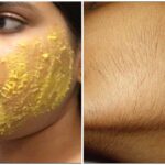 Health Tips: అమ్మాయిలకు మేలైన అస్త్రం.. ఇలా చేస్తే ముఖంపై వెంట్రుకలు మటుమాయం!