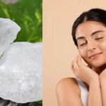 Pimples: మొటిమలతో ఇబ్బందిగా ఉందా?.. ఇలా ఒక్కసారి ట్రై చేస్తే  అంతా ఫసక్!