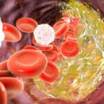 bad cholesterol control tips : ఓరి దేవుడా నిజమా.. చెడు కొలెస్ట్రాల్ తగ్గాలంటే ఇవి తప్పకుండా పాటించాల్సిందే.. !