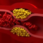 bad cholesterol control tips: చెడు కొలెస్ట్రాల్‌ను కంట్రోల్ చేయాలంటే.. ఇవి తప్పక పాటించాలి!